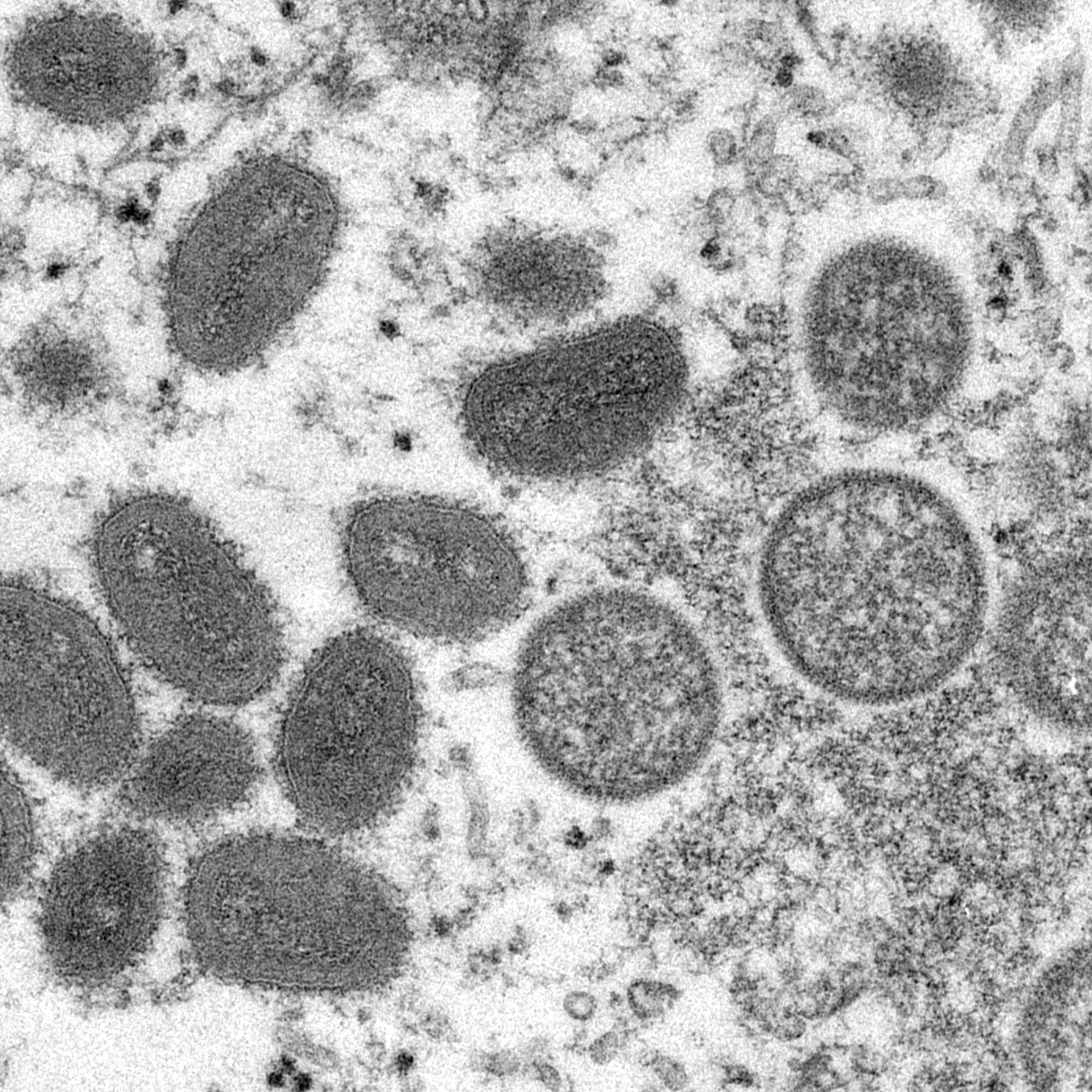 Monkeypox Virus: India Reports Fourth Case